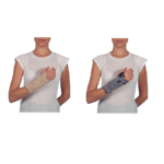 PRIM wrist splint (long)